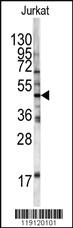 Anti-HFE Rabbit Polyclonal Antibody