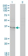 Anti-HHEX Mouse Monoclonal Antibody [clone: 1A2]