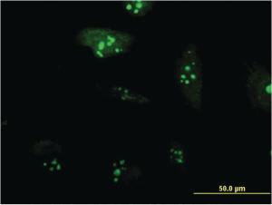 Anti-RPL23A Mouse Monoclonal Antibody [clone: 3E11]