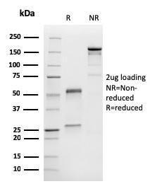 SDS-PAGE analysis of Anti-MelanA Antibody [M2-9E3] under non-reduced and reduced conditions; showing intact IgG and intact heavy and light chains, respectively. SDS-PAGE analysis confirms the integrity and purity of the antibody