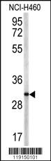 Anti-ACP5 Rabbit Polyclonal Antibody