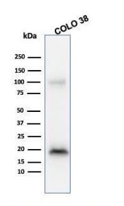 Western blot analysis of COLO-38 cell lysate using Anti-MelanA Antibody [M2-9E3]