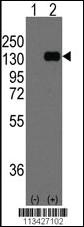 Anti-CDH1 Rabbit Polyclonal Antibody