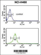 Anti-ACP5 Rabbit Polyclonal Antibody