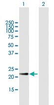 Anti-CRK Mouse Polyclonal Antibody