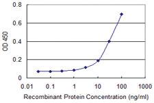 Anti-CAP2 Mouse Monoclonal Antibody [clone: 3G9-1A5]