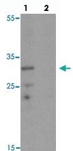 Anti-CEBPD Rabbit Polyclonal Antibody