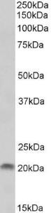 Anti-SPINT2 Antibody (A82516) (1 µg/ml) staining of Human Placenta lysate (35 µg protein in RIPA buffer). Primary incubation was 1 hour. Detected by chemiluminescence