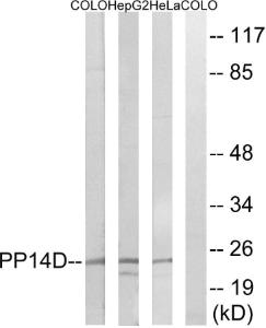 Western blot analysis of lysates from HeLa, HepG and COLO cells using Anti-PPP1R14D Antibody. The right hand lane represents a negative control, where the antibody is blocked by the immunising peptide