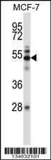 Anti-MAP3K7 Rabbit Polyclonal Antibody (Biotin)