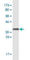 Anti-LMTK2 Mouse Monoclonal Antibody [clone: 3G1]