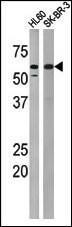 Anti-MYT1 Rabbit Polyclonal Antibody