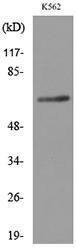 Western blot analysis of lysate from K562 cells using Anti-FZD10 Antibody