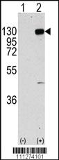 Anti-WBSCR16 Rabbit Polyclonal Antibody