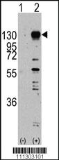 Anti-FGFR1 Rabbit Polyclonal Antibody