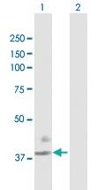 Anti-F3 Mouse Polyclonal Antibody