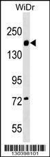 Anti-ITGA2 Rabbit Polyclonal Antibody (APC (Allophycocyanin))