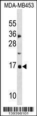 Anti-hp16-INK4A Rabbit Polyclonal Antibody (FITC (Fluorescein Isothiocyanate))