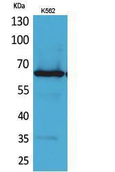 Western blot analysis of K562 cells using Anti-FZD10 Antibody