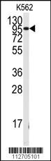 Anti-FGFR1 Rabbit Polyclonal Antibody