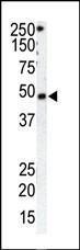 Anti-GRK1 Rabbit Polyclonal Antibody (PE (Phycoerythrin))