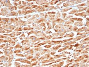 Immunohistochemical analysis of formalin-fixed, paraffin-embedded human heart tissue using Anti-SDHB Antibody [SDHB/6697R]