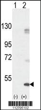 Anti-FGFR1 Rabbit Polyclonal Antibody