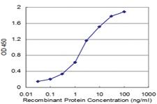 Anti-TCL1A Mouse Monoclonal Antibody [clone: 2D7]