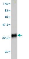 Anti-SLURP1 Mouse Monoclonal Antibody [clone: 4D1]