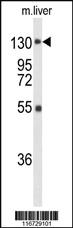 Anti-FGFR1 Rabbit Polyclonal Antibody