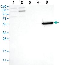 Anti-KCNV2 Rabbit Polyclonal Antibody