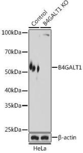 Antibody anti-B4GALT1 100 µl