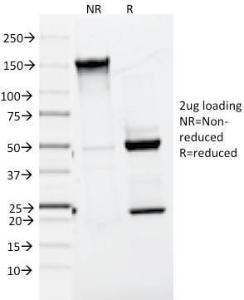 SDS-PAGE analysis of Anti-MelanA Antibody [A103] under non-reduced and reduced conditions; showing intact IgG and intact heavy and light chains, respectively. SDS-PAGE analysis confirms the integrity and purity of the antibody