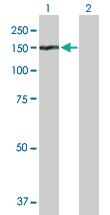 Anti-TDRD1 Mouse Polyclonal Antibody