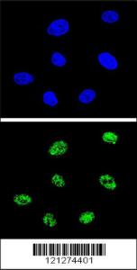 Anti-TP73 Rabbit Polyclonal Antibody (APC (Allophycocyanin))