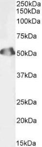 Anti-SEPT6 Antibody (A82520 / Biotin) (1µg/ml) staining of Human Testis lysate (35µg protein in RIPA buffer). Primary incubation was 1 hour. Detected by chemiluminescence, using streptavidin-HRP and using NAP blocker as a substitute for skimmed milk.