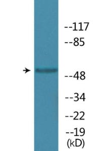 Western blot analysis of lysates from K562 cells treated with Na3VO4 0.3nM 40' using Anti-MAPKAPK5 (phospho Thr182) Antibody