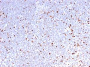 Immunohistochemical analysis of formalin-fixed, paraffin-embedded human lymph node using Anti-MCM7 Antibody [MCM7/2832R]