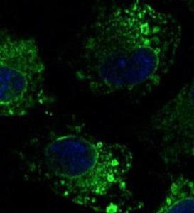 Hepa 1-6 cells, fixed with 4% PFA, stained with Anti-Calnexin Antibody at a 1:100 dilution