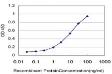 Anti-TCL1A Mouse Monoclonal Antibody [clone: 1G10]