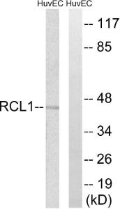 Western blot analysis of lysates from HUVEC cells using Anti-RCL1 Antibody. The right hand lane represents a negative control, where the antibody is blocked by the immunising peptide