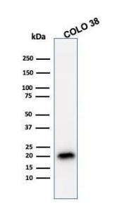 Western blot analysis of COLO-38 cell lysate using Anti-MelanA Antibody [A103]