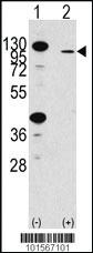 Anti-FGFR2 Rabbit Polyclonal Antibody