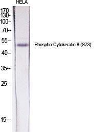 Western blot analysis of various cells using Anti-Keratin 8 (phospho Ser73) Antibody