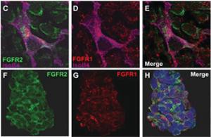 Anti-FGFR2 Rabbit Polyclonal Antibody