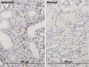 Anti-BKPyVgp4 Mouse Monoclonal Antibody [clone: 6E10]