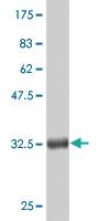 Anti-CTNNB1 Mouse Monoclonal Antibody [clone: 3A1]