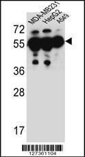 Anti-SOWAHC Rabbit Polyclonal Antibody (HRP (Horseradish Peroxidase))