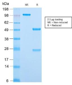 SDS-PAGE analysis of Anti-MCM7 Antibody [MCM7/2832R] under non-reduced and reduced conditions; showing intact IgG and intact heavy and light chains, respectively. SDS-PAGE analysis confirms the integrity and purity of the antibody