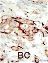 Anti-FGFR2 Rabbit Polyclonal Antibody